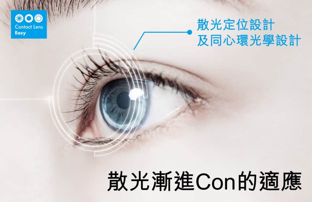 有散光又有老花,如何選擇漸進隱形眼鏡/老花隱形眼鏡 如何選擇漸進隱形眼鏡_info2
