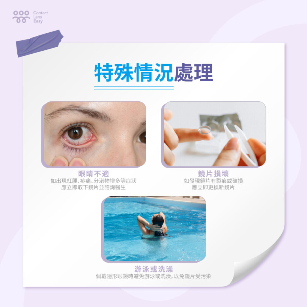 Color contact lens：打造迷人雙眸的完美選擇-11
